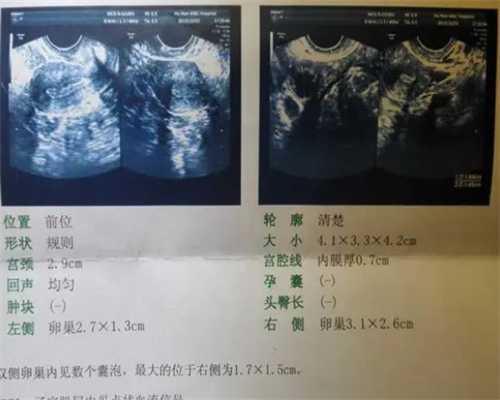 北京供卵自怀价格,北京供卵公司有哪些？附2023北京试管助孕医院排名！