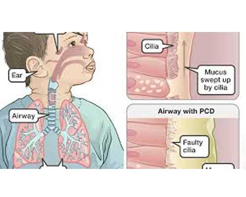 男性不育的原因，男性不孕不育症状