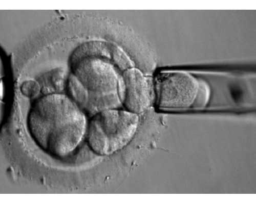 北京供卵三代试管,北京试管婴儿流程关爱上海坤和