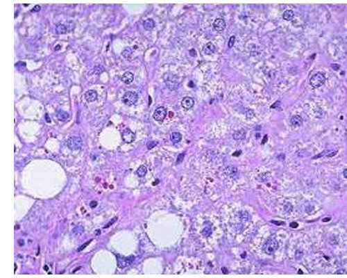 北京供卵试管去哪找医生,北京大学人民医院试管婴儿有哪些成功的案例？