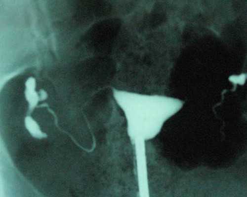 手机下单“回收小哥”上门收废品