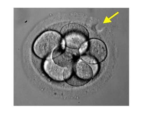 北京代孕佣金多少|宿迁供卵医院吗：宿迁哪家医院做试管