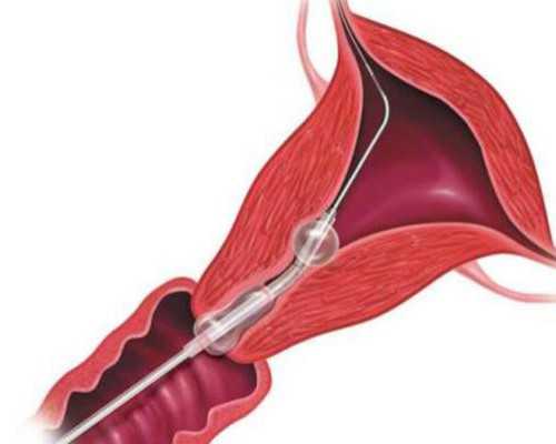 北京三代试管公司|北京助孕机构在哪里-北京供卵试管正规医院在哪里