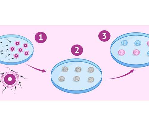 北京做助孕全过程介绍医生,2023年在北京妇产医院做一次试管婴儿大概要多少钱