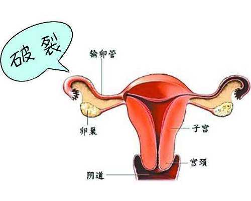 北京高龄供卵助孕,北京公立医院供卵价格？