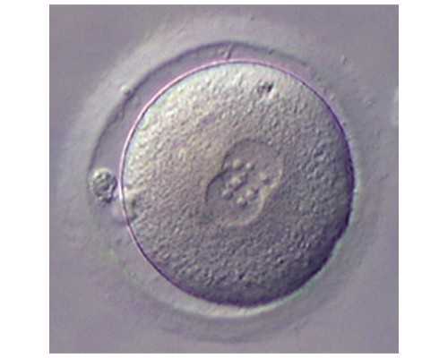 北京AA69捐卵代孕网|昭通试管婴儿费用明细-2023昭通试管费用报销补贴申请流程