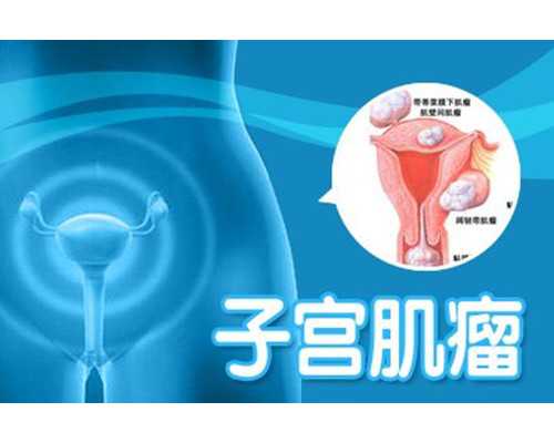 猫cfa与wcf哪个更权威？