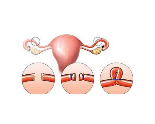 北京代怀代生孕,北京妇产医院能做三代试管婴儿移植手术吗？,2023北京农村给孩