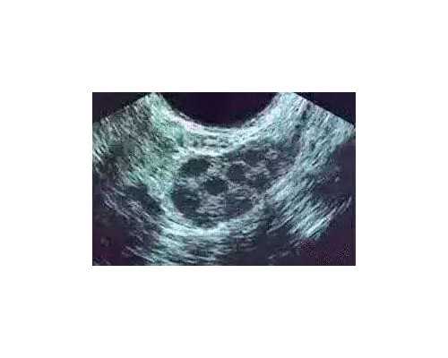 北京哪些医院能够提供第三代试管技术服务？,北京市第一人民医院生殖医学中