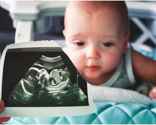 双胞胎的生产方式