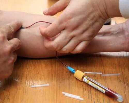 做试管婴儿要满足哪些条件？