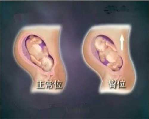 代孕产子公司北京_代生小孩哪家公司好_孕妇能不